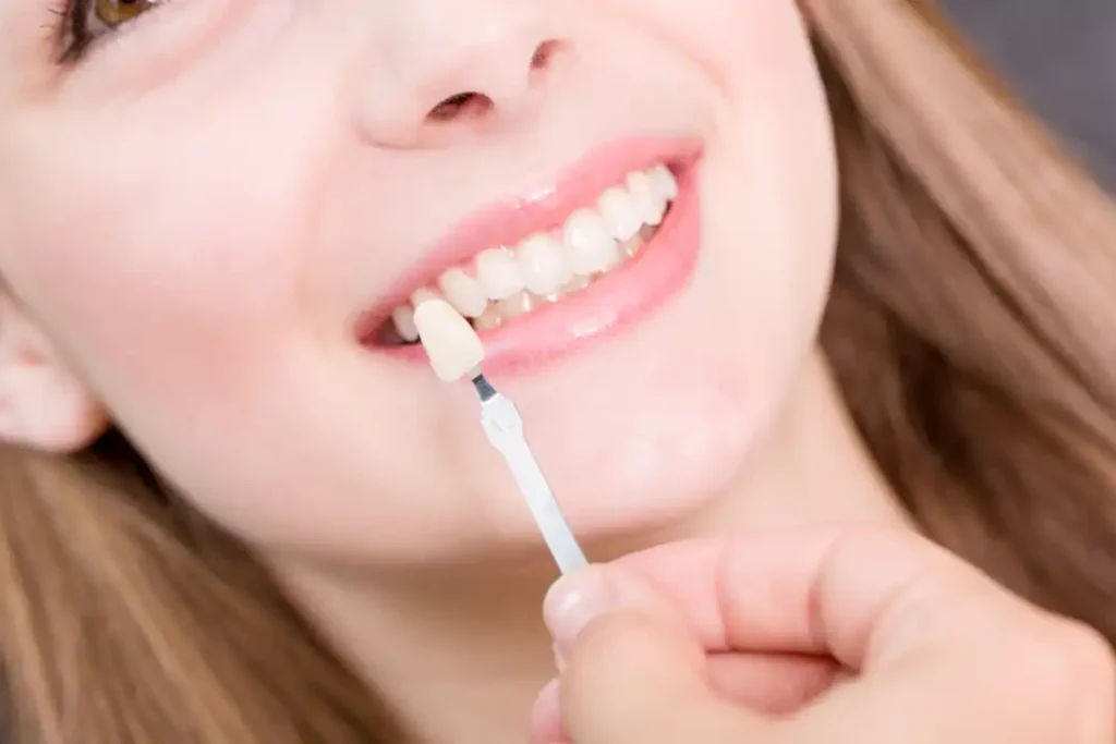 Dental Crowns Chatswood 017.webp